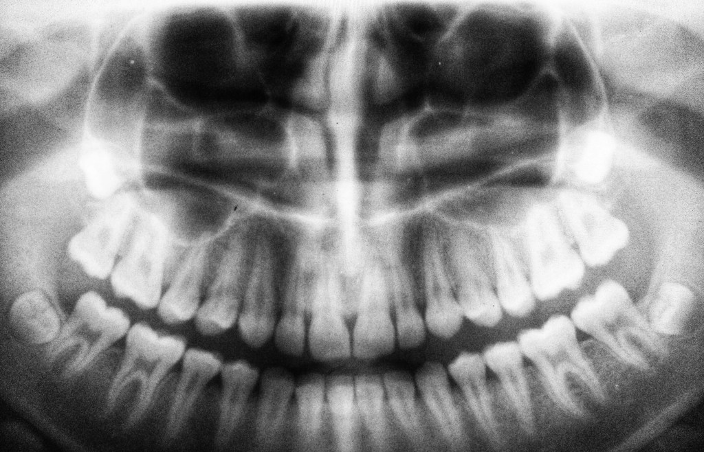 A heart in&nbsp;training